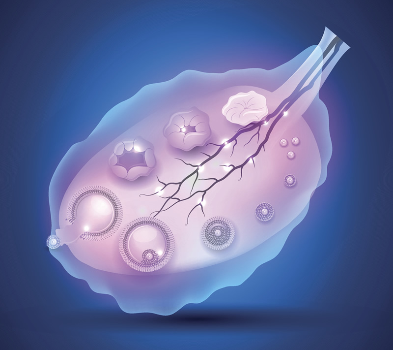 怀孕前查出腺肌症想问一下生产后会不会自己好？